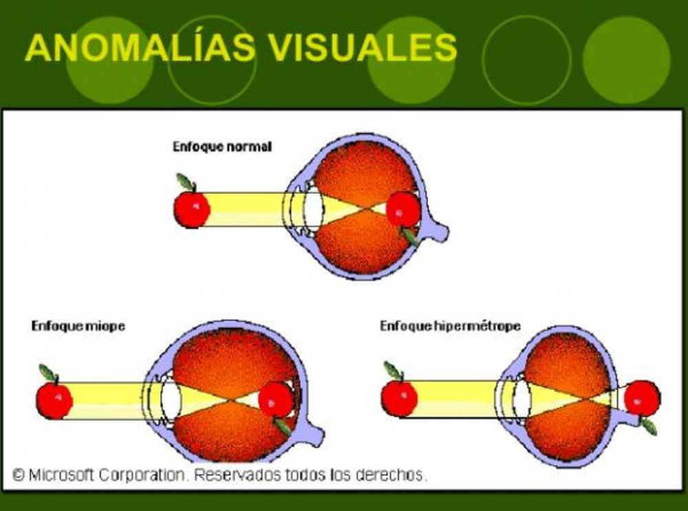 दृष्टि विसंगतियाँ - मूल मनोविज्ञान