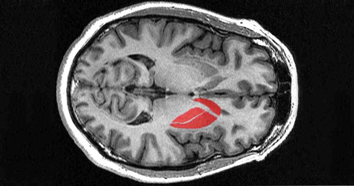 Striated kroppsstruktur, funktioner och därtill hörande störningar / neurovetenskap