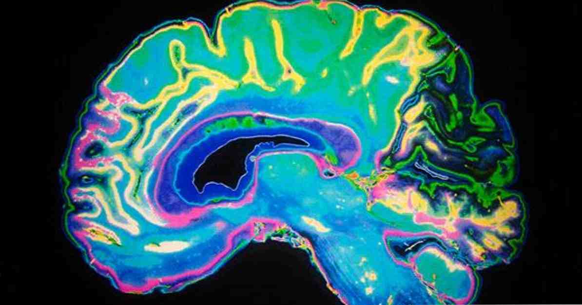 Selle neurotransmitteri peamised funktsioonid on dopamiin 7 / Neuroteadused