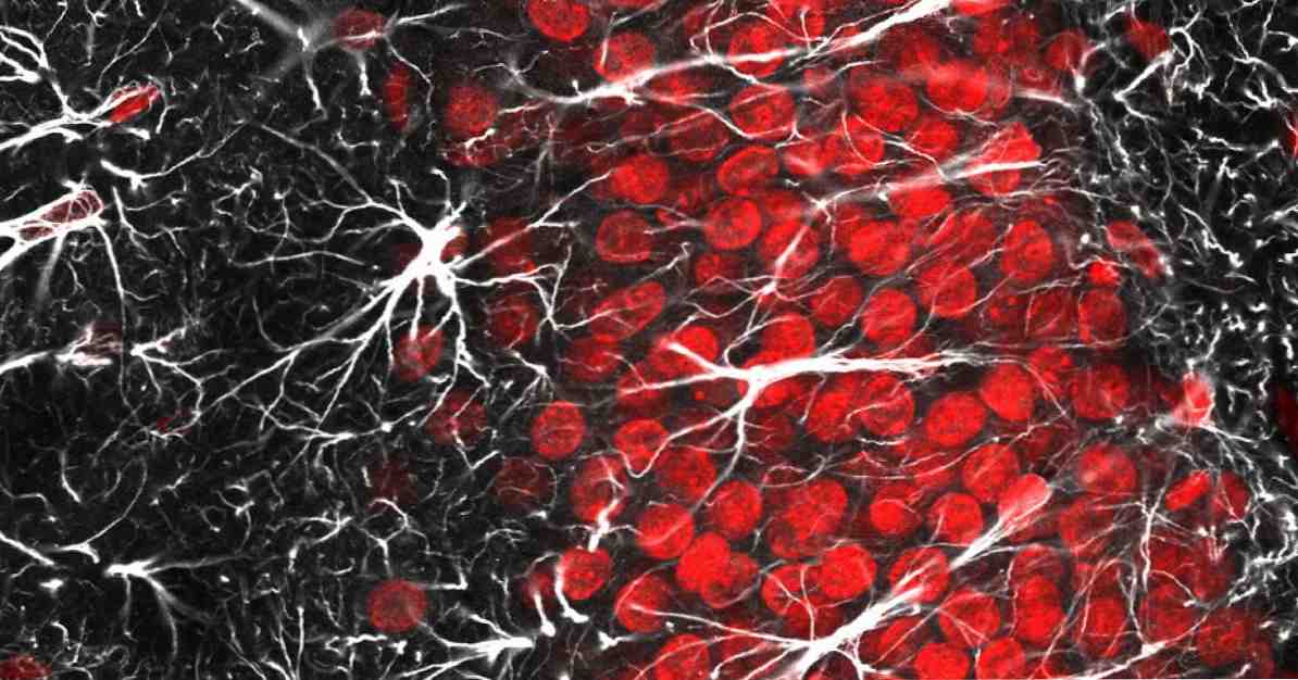 Úloha glia při neurologických onemocněních / Klinická psychologie