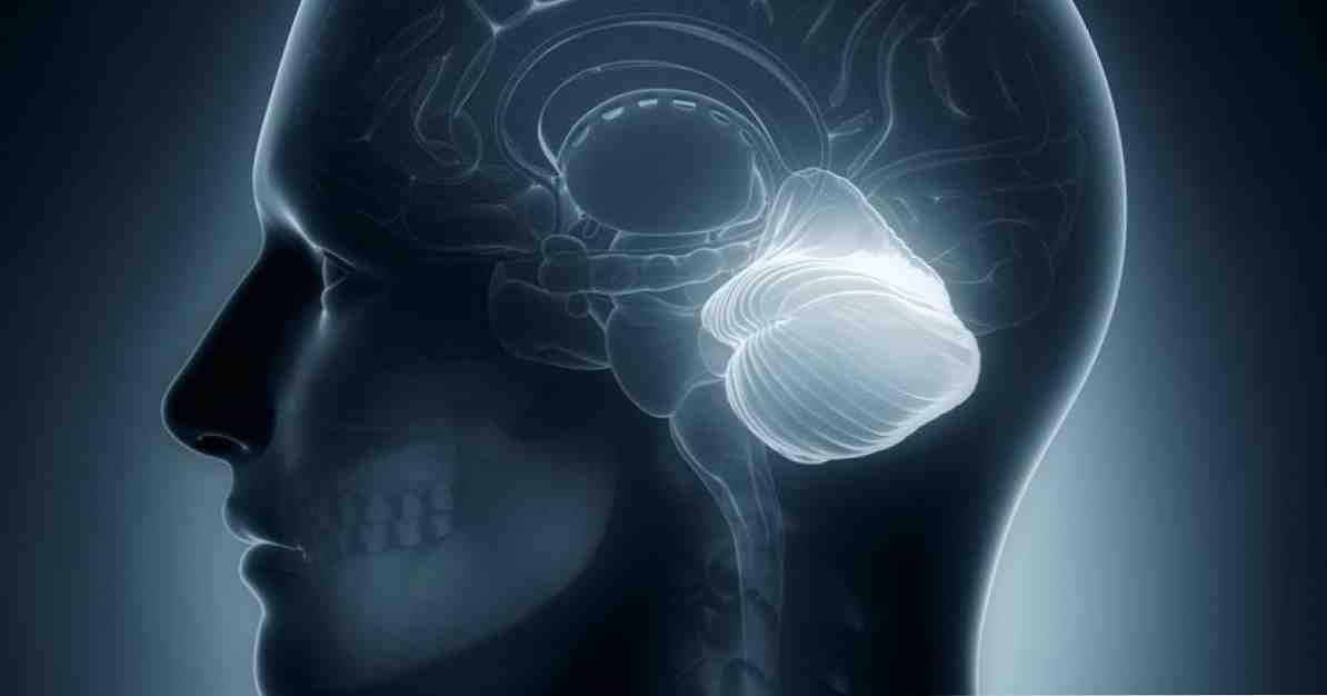 תכונות של המוח הקטן והסימפטומים / פסיכולוגיה קלינית