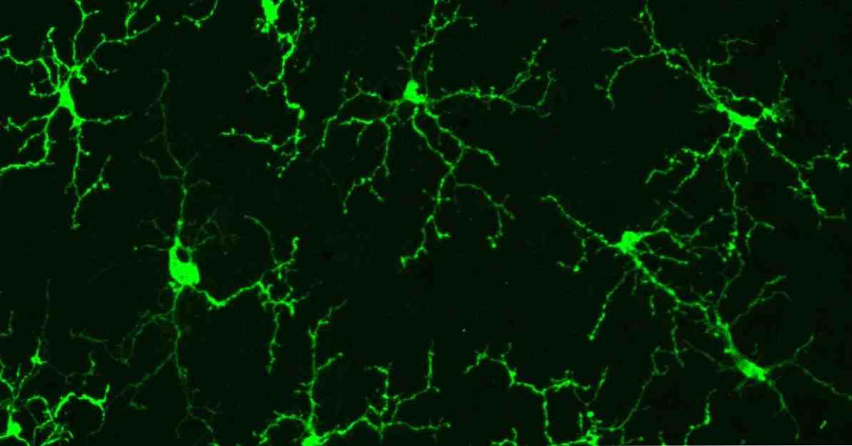 หน้าที่หลักของ Microglia และโรคที่เกี่ยวข้อง / ประสาท