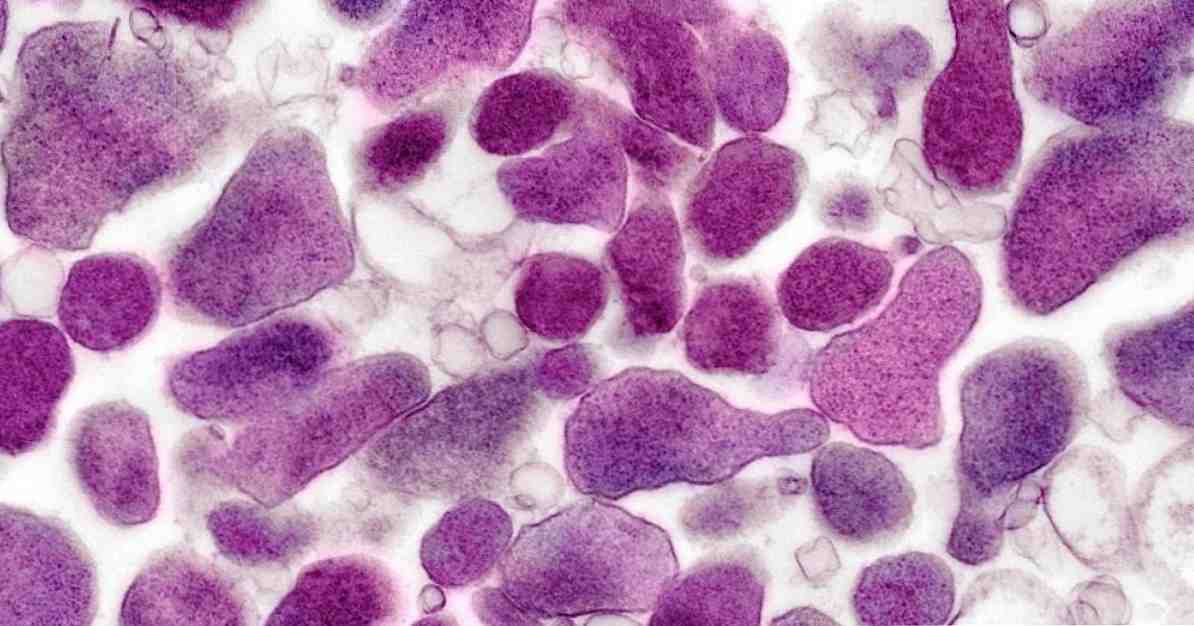 Mycoplasma genitalium symptom, orsaker och behandling av denna STD
