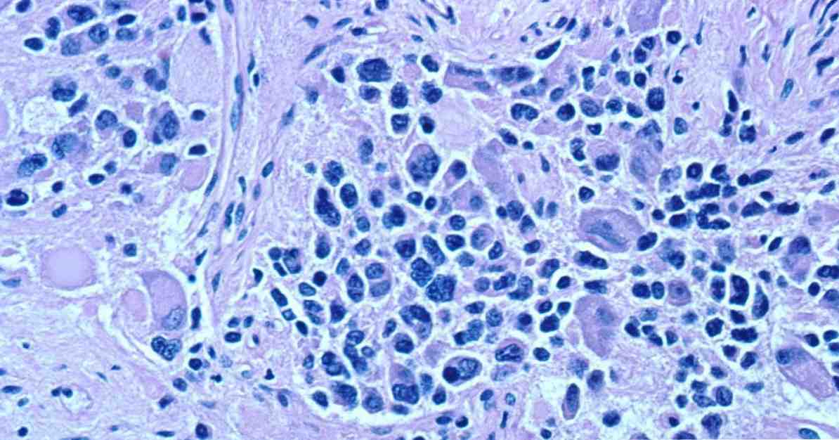 Hermosolujen neuroblastien prekursorit / neurotieteiden