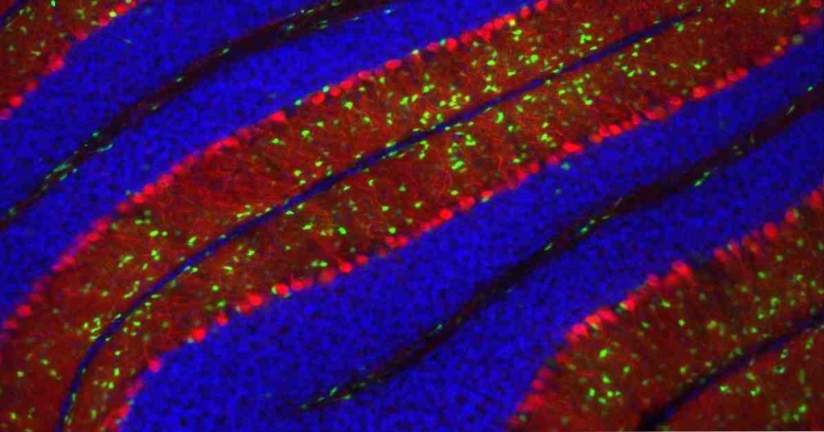 Purkinje neuronen hun functies en kenmerken / neurowetenschappen