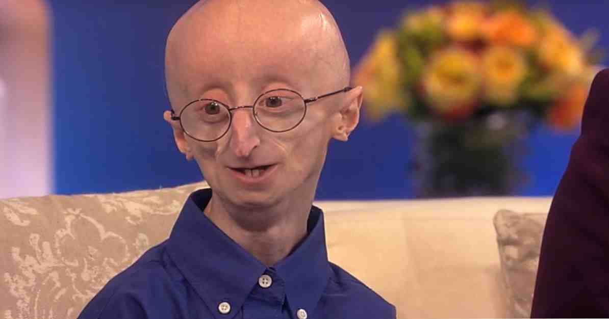 Vzroki, simptomi in zdravljenje progerije