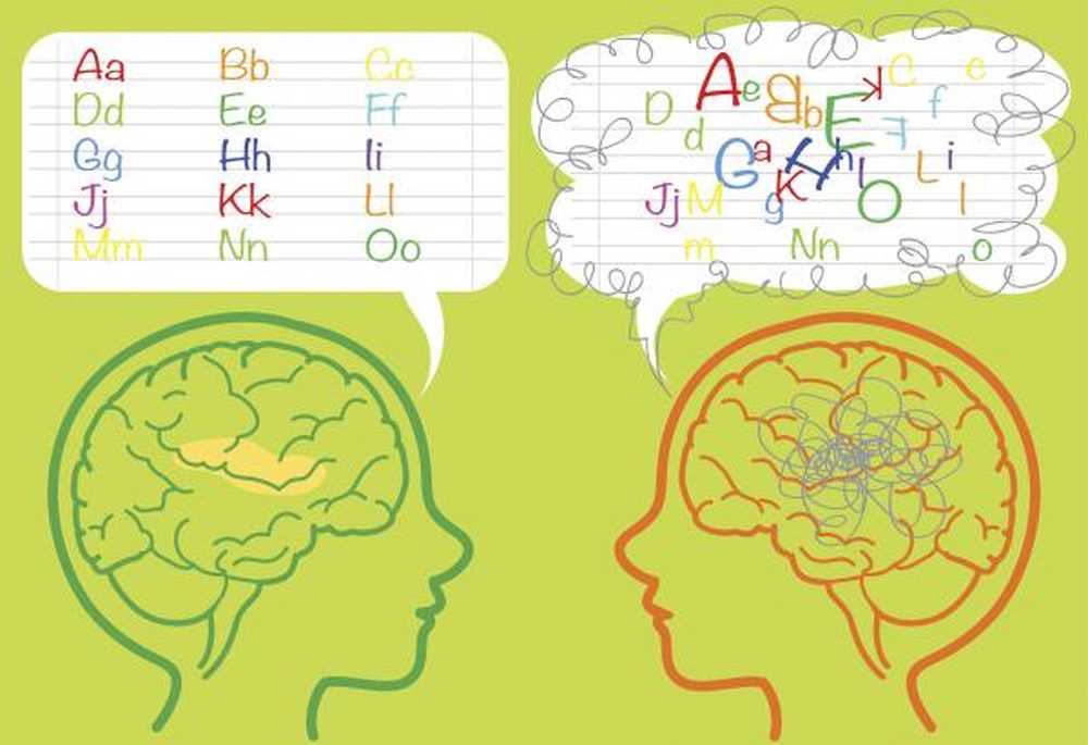 Výsledek obrázku pro dyslexie mozek