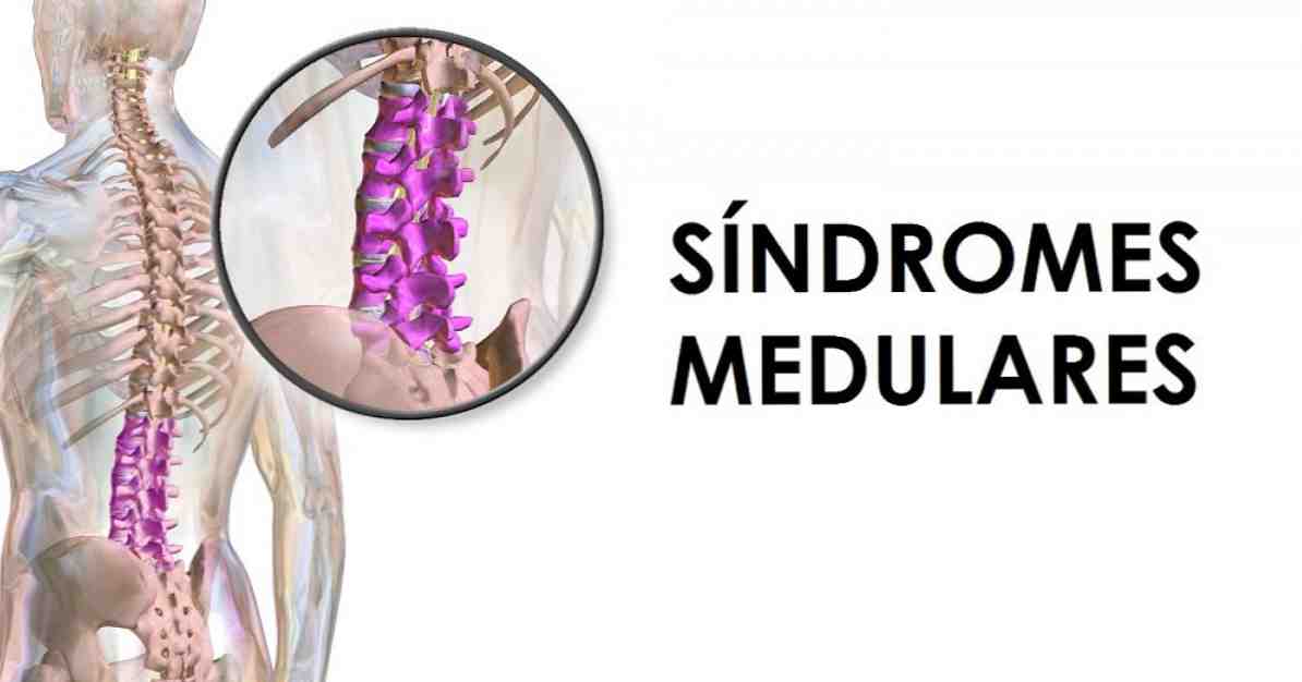 Syndromes spinaux types, causes et symptômes / Psychologie clinique