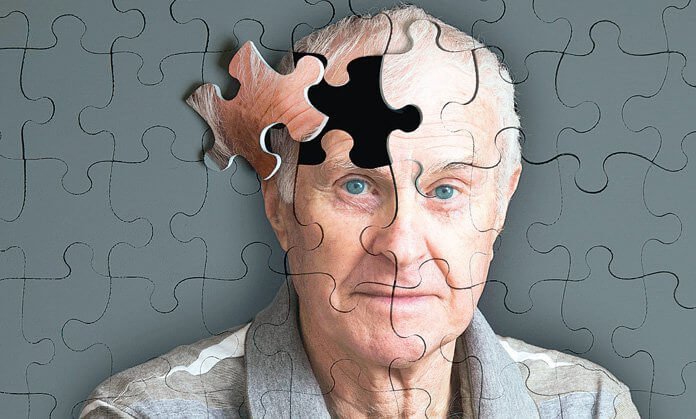 5 dấu hiệu có trước Alzheimer / Tâm lý học