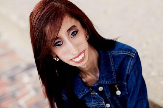 Lizzie Velásquez, najškaredšia žena na svete? / psychológie